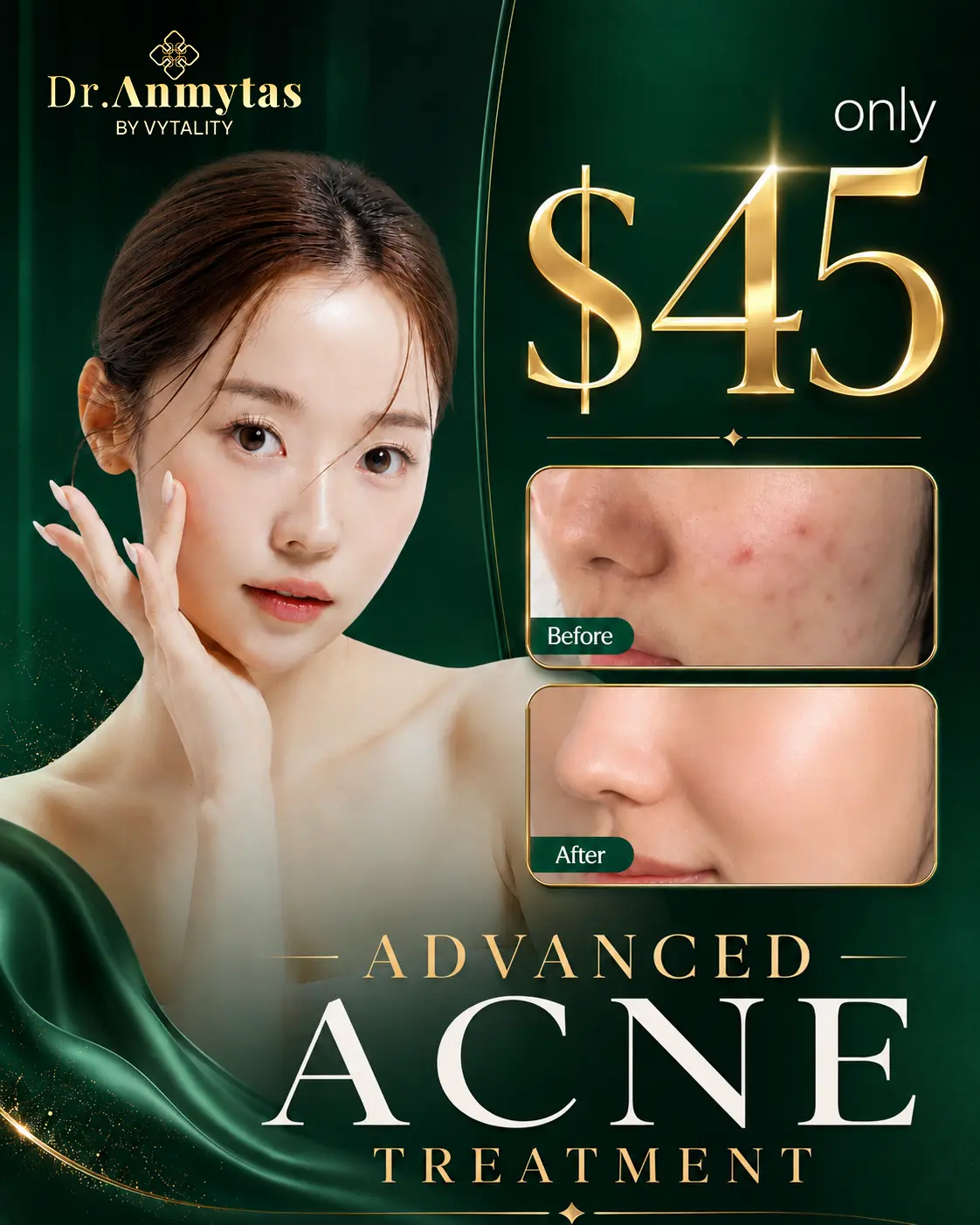 Advanced Acne Treatment at Dr.Anmytas — only $45, real before and after results