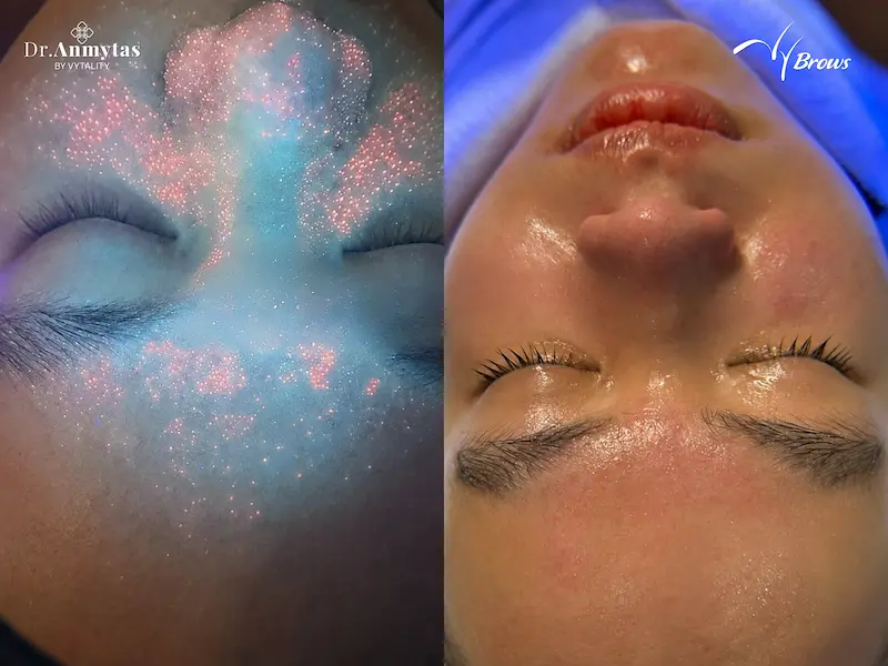 UV skin scan and hands-on treatment at VyBrows