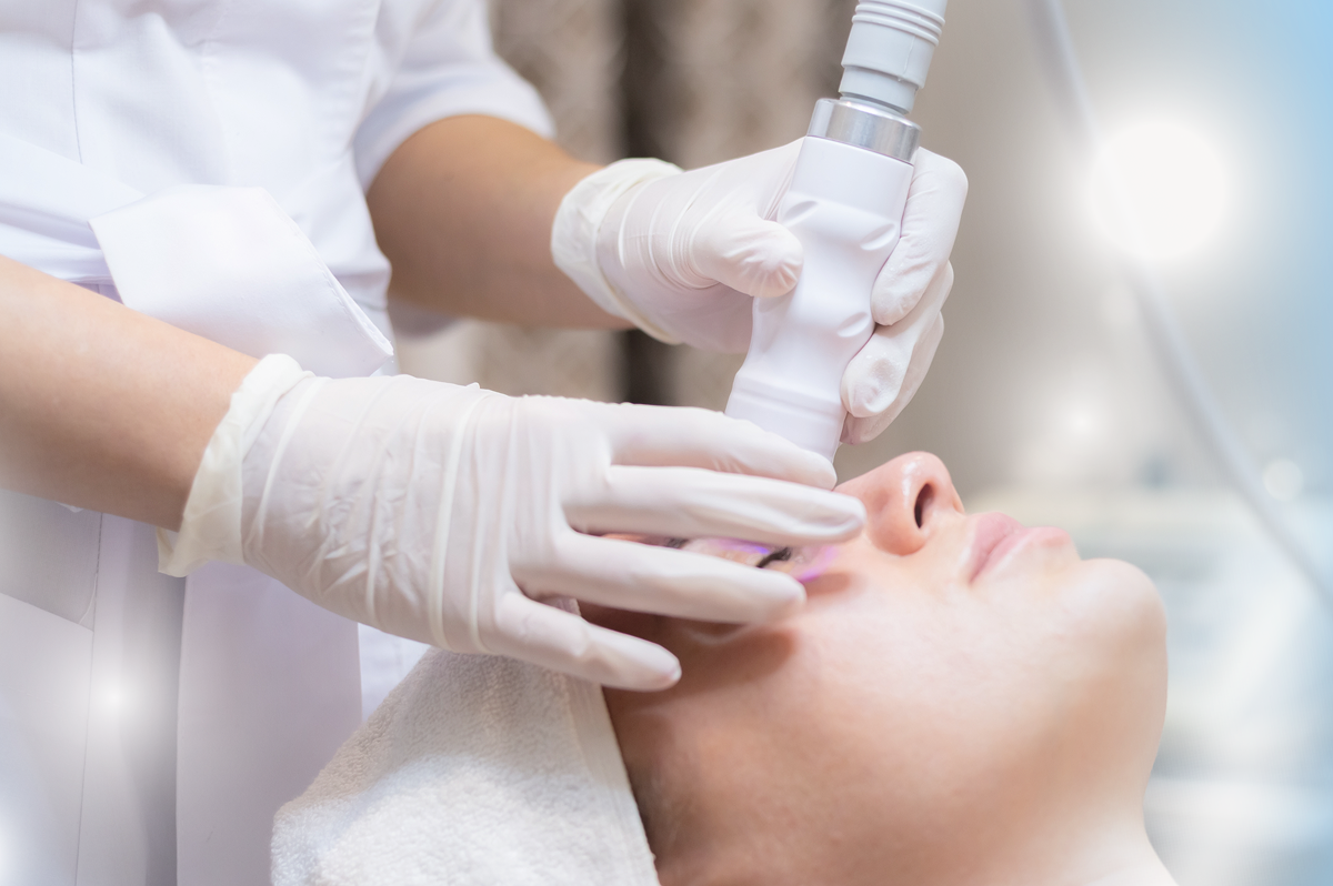 Advanced acne treatment at VyBrows